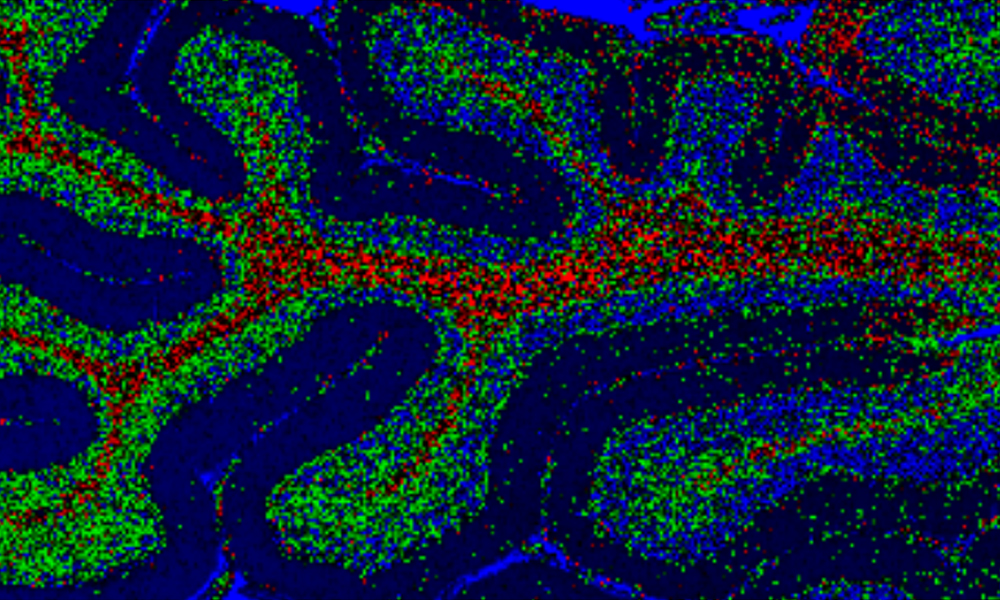 Obraz ramanowski tkanki mózgowej