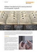 Case study:  Additive manufacturing for serial production of orthopaedic implants